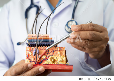 Asian dermatologist doctor holding skin structure model anatomy for treatment in hospital, hair transplant. 137528559
