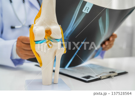 Doctor examining knee joint bone radiography xray film. 137528564