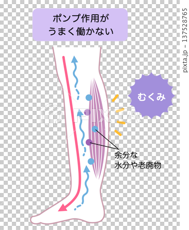 脚のむくみ 浮腫のしくみ 脚のむくみ 浮腫のしくみ 137528765
