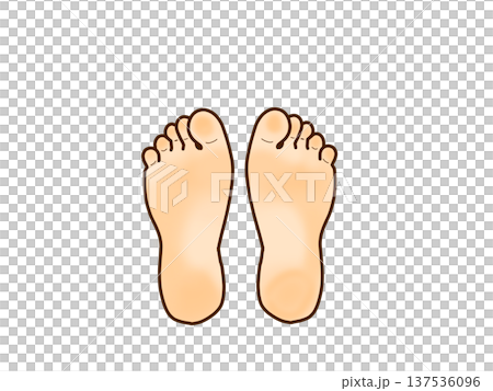 Hallux valgus Hallux valgus 137536096