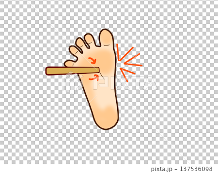 Acupressure, self-care Acupressure, self-care 137536098