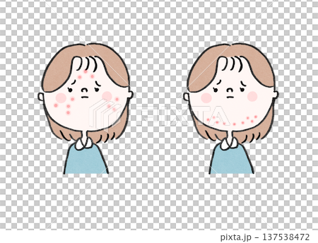 思春期ニキビに悩む女性と大人ニキビに悩む女性（吹き出物の部位の比較） 137538472