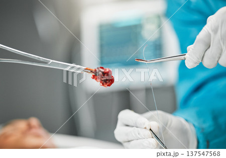 Surgery, doctors hands on tools and stitches with equipment, teamwork and support in hospital. Nurse helping medical surgeon, blood and patient in bed for safety, operation and emergency care in ER. 137547568