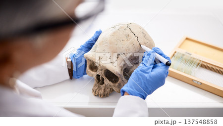 Science, professional and person with skull in hand for analysis or research for medical history in laboratory. Anatomy, human skeleton and dna evidence of bone or head for forensic study or lab test Science, professional and person with skull in hand for analysis or research for medical history in laboratory. Anatomy, human skeleton and dna evidence of bone or head for forensic study or lab test 137548858