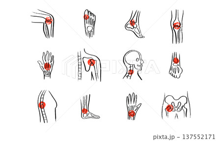 Arthritis Sketch Poster 137552171