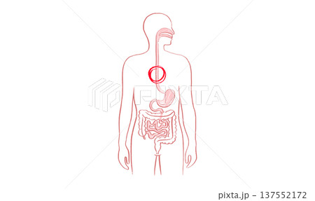 Esophagus pain diagram 137552172