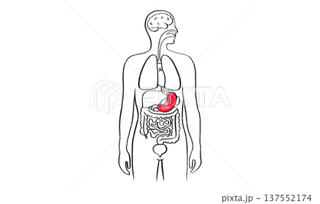 Gastroesophageal reflux pain Gastroesophageal reflux pain 137552174