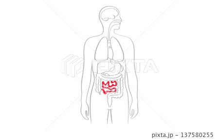 Intestine diseases sketch Intestine diseases sketch 137580255