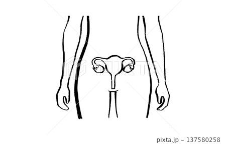 Uterus medical illustration Uterus medical illustration 137580258
