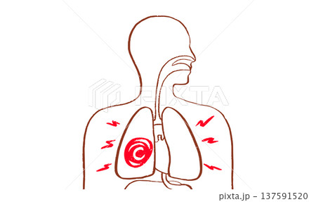 Lung disease concept 137591520