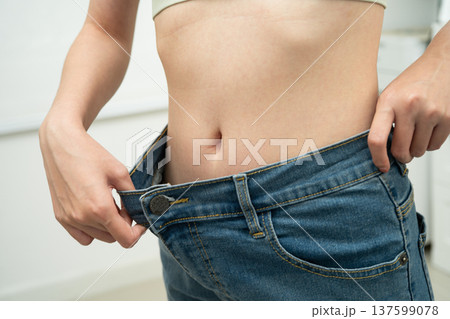 Young Asian woman losing weight wearing loose pants in oversize jeans. 137599078