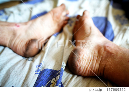 Dirty feet on bed with patterned blanket in bright light during daytime in flat. Dirty feet on bed with patterned blanket in bright light during daytime in flat. 137609322