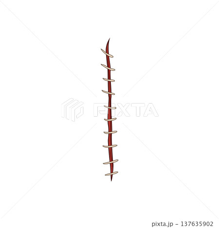 technique suture cartoon vector illustration technique suture cartoon vector illustration 137635902