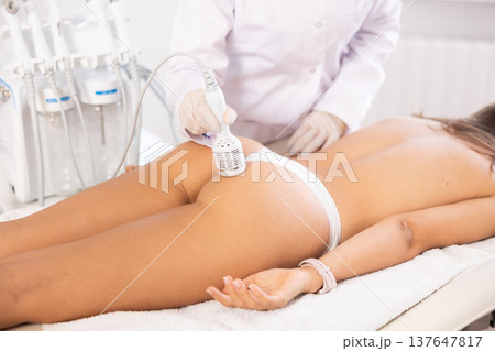 Aesthetician performing cryotherapy using cooling attachment on female client buttocks 137647817
