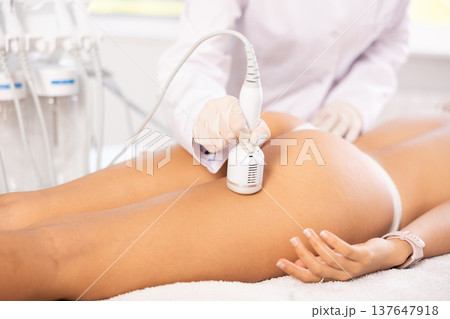 Aesthetician administering ice hammer therapy to tighten skin on female buttocks Aesthetician administering ice hammer therapy to tighten skin on female buttocks 137647918