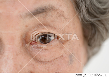シニア女性　目元 137655294