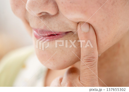 シニア女性　ほうれい線 137655302