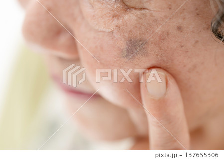 シニア女性　しみ 137655306
