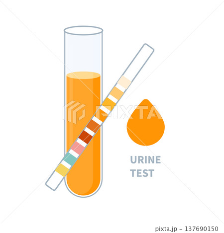 Urine sample tube and urinalysis reagent strip for kidney exam, urinary tract infection and cystitis diagnostics.  137690150