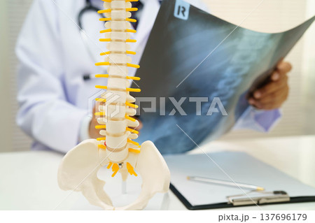 Doctor examining spine bone radiography xray film. 137696179