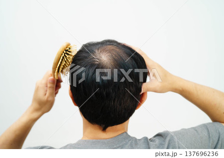 Bald in the middle head and begin no loss hair glabrous of mature man with comb. Bald in the middle head and begin no loss hair glabrous of mature man with comb. 137696236