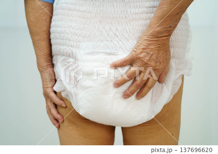 Asian senior woman patient wearing adult incontinence diaper pad in hospital. 137696620