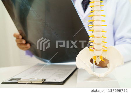 Doctor examining spine bone radiography xray film. Doctor examining spine bone radiography xray film. 137696732