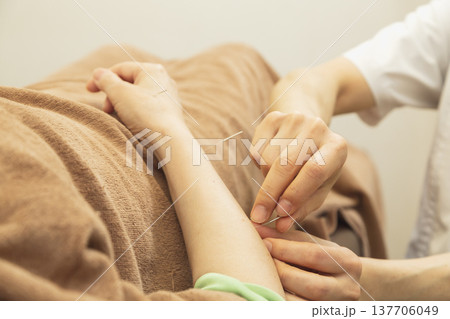 腕のツボに鍼を打つ鍼灸治療 鍼灸院での専門的な施術とメディカルケア 137706049