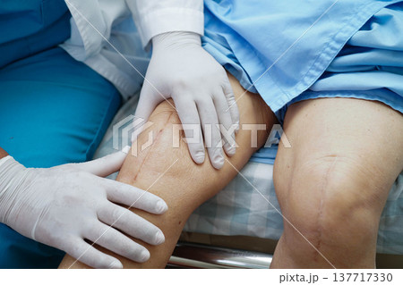 Doctor checking Asian elderly woman patient with scar knee replacement surgery in hospital. Doctor checking Asian elderly woman patient with scar knee replacement surgery in hospital. 137717330