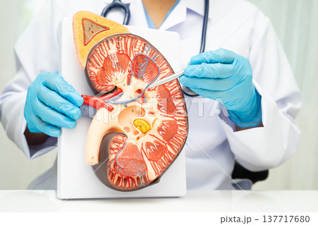 Chronic kidney disease, doctor with model for treatment urinary system, urology, Estimated glomerular filtration rate eGFR. Chronic kidney disease, doctor with model for treatment urinary system, urology, Estimated glomerular filtration rate eGFR. 137717680