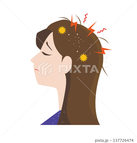 頭皮トラブルで悩む女性 137726474