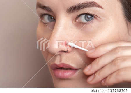 Inflamed nose piercing. Caucasian woman swabbing the piercing site with chlorhexidine on a cotton swab. Post piercing care. Close up photo 137768502
