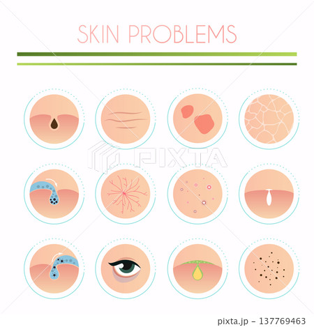 Skin problems solution, home remedies. Skincare and dermatology concept. Flat design modern vector illustration concept. 137769463