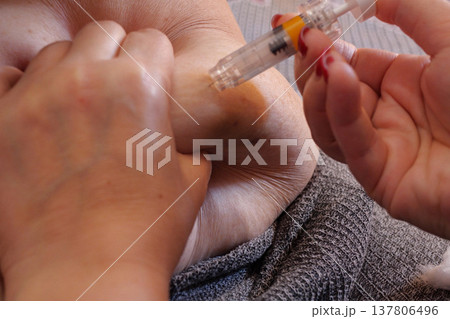 Woman is injecting hormones to belly with syringe. IVF concept close up Woman is injecting hormones to belly with syringe. IVF concept close up 137806496