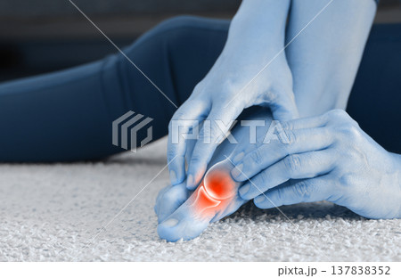 Close up of woman massaging painful big toe with anatomical joint illustration and red highlight. Hallux valgus, gout, bunion and bone inflammation concept for medical health care. 137838352