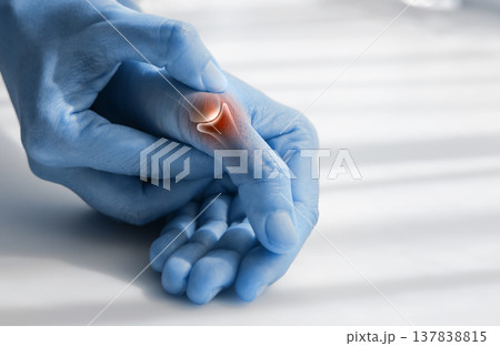 Close up of woman massaging painful thumb with anatomical joint illustration and red highlight. Arthritis, gout, trigger finger and bone inflammation concept for medical health care. Close up of woman massaging painful thumb with anatomical joint illustration and red highlight. Arthritis, gout, trigger finger and bone inflammation concept for medical health care. 137838815