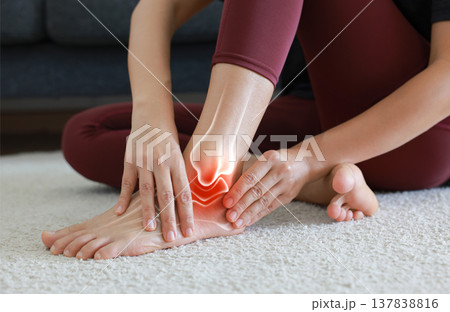 Woman standing and massaging her painful ankle with anatomical bone and joint illustration. Ankle sprain, arthritis, Achilles tendonitis and ligament injury concept for medical health care. Woman standing and massaging her painful ankle with anatomical bone and joint illustration. Ankle sprain, arthritis, Achilles tendonitis and ligament injury concept for medical health care. 137838816