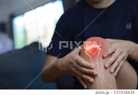Woman massaging her painful knee with anatomical joint and bone illustration. Knee osteoarthritis, patellar tendonitis, meniscus tear and inflammation concept for medical health care. Woman massaging her painful knee with anatomical joint and bone illustration. Knee osteoarthritis, patellar tendonitis, meniscus tear and inflammation concept for medical health care. 137838834