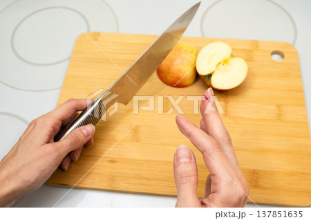 A close-up of hands with a cut finger and a drop of blood on a cutting board with a sliced apple and knife on a kitchen counter first aid health safety accident cooking concept A close-up of hands with a cut finger and a drop of blood on a cutting board with a sliced apple and knife on a kitchen counter first aid health safety accident cooking concept 137851635