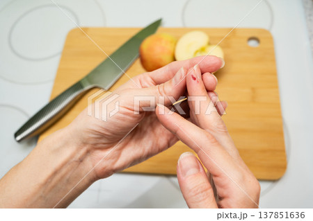 A close-up of hands examining a cut finger with a drop of blood near a cutting board with an apple and knife on a kitchen counter first aid health safety accident cooking concept A close-up of hands examining a cut finger with a drop of blood near a cutting board with an apple and knife on a kitchen counter first aid health safety accident cooking concept 137851636