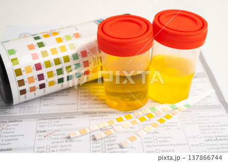 Urinalysis, urine cup with reagent strip pH paper test and comparison chart in laboratory. 137866744