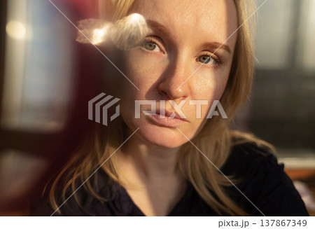 Close-up of female face with enlarged pores and oily skin, visible texture, redness on chin. Natural light beauty portrait, skincare concerns, dermatology concept. Close-up of female face with enlarged pores and oily skin, visible texture, redness on chin. Natural light beauty portrait, skincare concerns, dermatology concept. 137867349