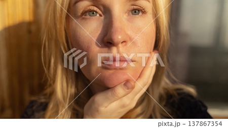 Close-up of female face with enlarged pores and oily skin, visible texture, redness on chin. Natural light beauty portrait, skincare concerns, dermatology concept. Close-up of female face with enlarged pores and oily skin, visible texture, redness on chin. Natural light beauty portrait, skincare concerns, dermatology concept. 137867354