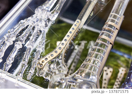 Titanium plates for splicing bones 137871575