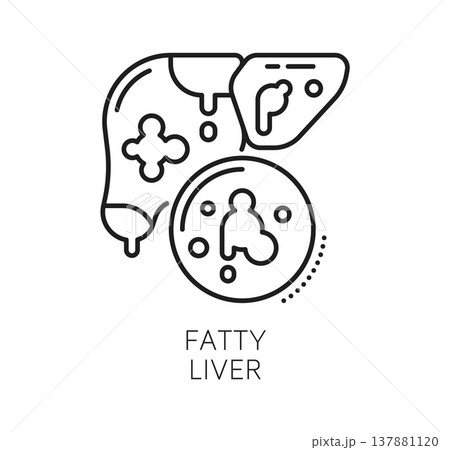 Chronic liver disease and therapy, medical line icon. Human liver with visual indicators for fatty liver disease. Linear vector icon for patient education materials, medical websites, presentation Chronic liver disease and therapy, medical line icon. Human liver with visual indicators for fatty liver disease. Linear vector icon for patient education materials, medical websites, presentation 137881120