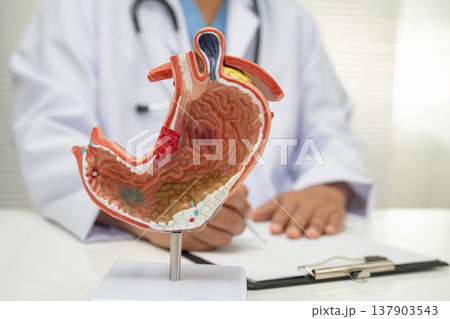 Stomach disease, doctor with anatomy model for study diagnosis and treatment in hospital. 137903543