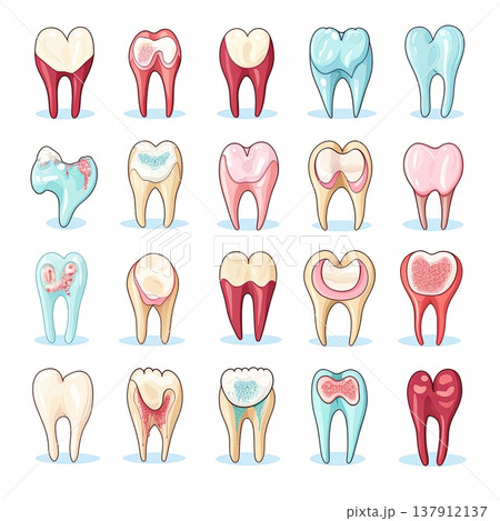 Dental Health Illustrative Guide to Tooth Decay Progression and Prevention Methods Dental Health Illustrative Guide to Tooth Decay Progression and Prevention Methods 137912137