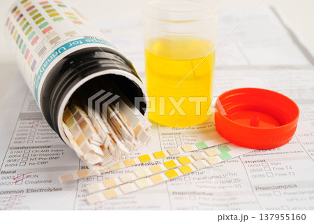 Urinalysis, urine cup for check health examination in laboratory. Urinalysis, urine cup for check health examination in laboratory. 137955160