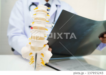 Doctor examining spine bone radiography xray film. Doctor examining spine bone radiography xray film. 137955243