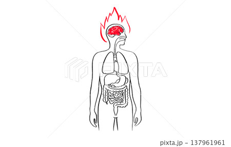 Brain disease concept 137961961